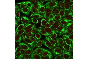 Confocal immunofluorescence image of HeLa cells using Cytokeratin 8 Mouse Monoclonal Antibody (K8/383). (KRT8 anticorps)