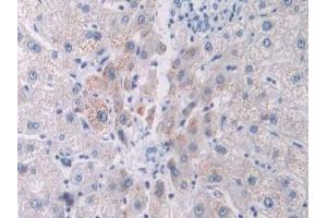Detection of PCOLCE in Human Liver Tissue using Polyclonal Antibody to Procollagen C-Endopeptidase Enhancer (PCOLCE)