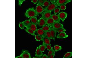 Immunofluorescence Analysis of HeLa cells labeling Smooth Muscle Actin with Smooth Muscle Actin Mouse Monoclonal Antibody (1A4) followed by Goat anti-Mouse IgG-CF488(Green).
