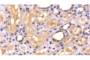 Detection of CASP8 in Human Kidney Tissue using Polyclonal Antibody to Caspase 8 (CASP8)