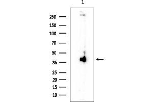 anti-Siah E3 Ubiquitin Protein Ligase 2 (SIAH2) (C-Term) antibody