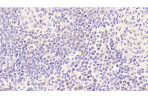Detection of bACE1 in Human Spleen Tissue using Polyclonal Antibody to Beta-Site APP Cleaving Enzyme 1 (bACE1)