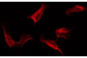ABIN6267264 staining SK-OV3 by IF/ICC. (EGFR anticorps  (pTyr1172))