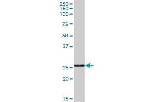 CTRB1 MaxPab polyclonal antibody.