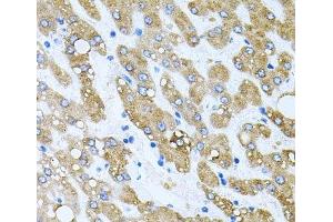 Immunohistochemistry of paraffin-embedded Human liver damage using TOB2 Polyclonal Antibody at dilution of 1:100 (40x lens).
