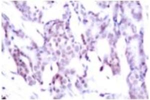 Image no. 2 for anti-Signal Transducer and Activator of Transcription 6, Interleukin-4 Induced (STAT6) (pThr645) antibody (ABIN318132)