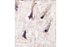 Formalin-fixed and paraffin-embedded human brain tissue reacted with PKC beta2 antibody (C-term), which was peroxidase-conjugated to the secondary antibody, followed by DAB staining.