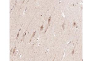 ABIN6266602 at 1/100 staining human brain tissue sections by IHC-P.