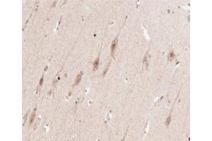 ABIN6266602 at 1/100 staining human brain tissue sections by IHC-P. (ENO2/NSE anticorps  (C-Term))