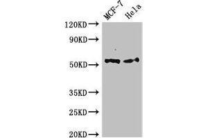 Western Blot Positive WB detected in: MCF-7 whole cell lysate, Hela whole cell lysate All lanes: PTK6 antibody at 2.
