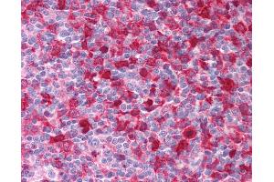 Anti-SYK antibody IHC of human tonsil. (SYK anticorps  (AA 5-360))