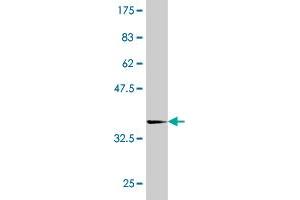 Western Blot detection against Immunogen (35. (TAO Kinase 3 anticorps  (AA 809-898))