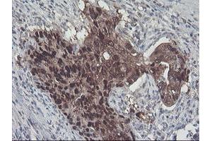 Image no. 10 for anti-Aminoacylase 1 (ACY1) antibody (ABIN1496455) (Aminoacylase 1 anticorps)