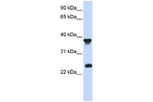 WB Suggested Anti-ATOH1 Antibody Titration:  0.