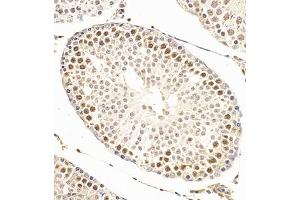 Immunohistochemistry of paraffin embedded rat testis using SCP1 (ABIN7075786) at dilution of 1:500 (300x lens)