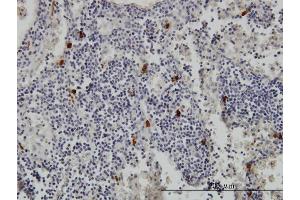 Immunoperoxidase of monoclonal antibody to TPSAB1 on formalin-fixed paraffin-embedded human lymph node.