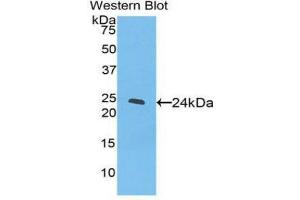 Western Blotting (WB) image for anti-Peroxisome Proliferator-Activated Receptor gamma (PPARG) (AA 311-500) antibody (ABIN3207607) (PPARG anticorps  (AA 311-500))