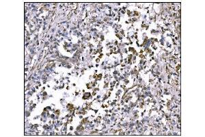 IHC analysis of NDEL1 using anti-NDEL1 antibody (ABIN7602511). (NDEL1 anticorps  (AA 80-320))