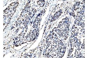 IHC analysis of DLX2 using anti-DLX2 antibody (ABIN7599936). (DLX2 anticorps  (AA 13-310))