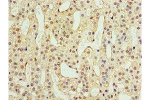 Immunohistochemistry of paraffin-embedded human adrenal gland tissue using ABIN7144559 at dilution of 1:100