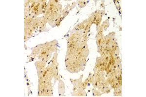 Immunohistochemistry of paraffin-embedded Human esophageal using MVP antibody at dilution of 1:100 (x400 lens).
