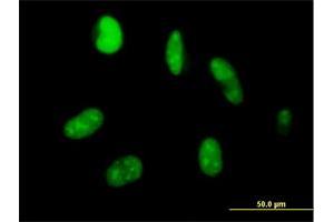 Immunofluorescence of purified MaxPab antibody to ZNF331 on HeLa cell. (ZNF331 anticorps  (AA 1-463))