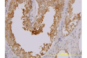 Immunoperoxidase of monoclonal antibody to MARCKSL1 on formalin-fixed paraffin-embedded human testis.