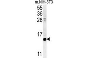 Western Blotting (WB) image for anti-Cellular Retinoic Acid Binding Protein 1 (CRABP1) antibody (ABIN3002339)