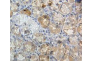 Used in DAB staining on fromalin fixed paraffin-embedded stomach tissue (Neuromedin U anticorps  (AA 35-158))