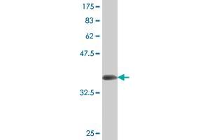 Western Blot detection against Immunogen (36. (ATG5 anticorps  (AA 176-275))