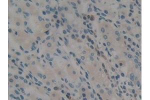 Detection of ACF in Human Stomach Tissue using Polyclonal Antibody to Apobec 1 Complementation Factor (ACF)