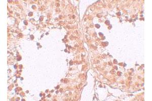 Immunohistochemical staining of human testis cells with CRISP2 polyclonal antibody  at 10 ug/mL. (CRISP2 anticorps  (N-Term))