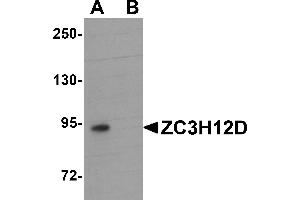 Western blot analysis of ZC3H12D in THP-1 cell lysate with ZC3H12D antibody at 1 µg/mL in (A) the absence and (B) the presence of blocking peptide. (ZC3H12D anticorps  (C-Term))