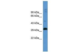 ADORA2B antibody used at 0. (Adenosine A2b Receptor anticorps  (C-Term))