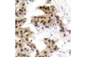 Immunohistochemistry (IHC) image for anti-Nuclear Factor of kappa Light Polypeptide Gene Enhancer in B-Cells 1 (NFKB1) (pSer893) antibody (ABIN1870468) (NFKB1 anticorps  (pSer893))