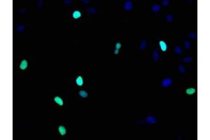 Immunofluorescence staining of Hela cells with ABIN7127295 at 1:93,counter-stained with DAPI.