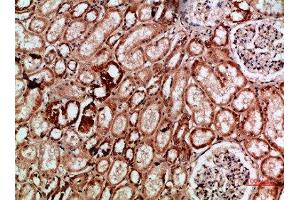 Immunohistochemical analysis of paraffin-embedded human-kidney, antibody was diluted at 1:200 (IMP3 anticorps  (AA 135-184))