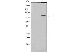 Western blot analysis on MDA-MB-435 cell lysate using MMP15 Antibody.