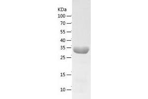 Western Blotting (WB) image for ADP-Ribosylation Factor-Like 5B (ARL5B) (AA 1-299) protein (His-IF2DI Tag) (ABIN7121749)
