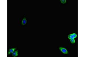 Immunofluorescent analysis of HepG2 cells using ABIN7157938 at dilution of 1:100 and Alexa Fluor 488-congugated AffiniPure Goat Anti-Rabbit IgG(H+L) (LTBP4 anticorps  (AA 977-1180))