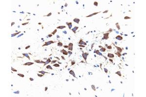 Immunohistochemical staining for Dynamin II on a rat brain section, zinc-fixed paraffin-embedded (40X magnification).