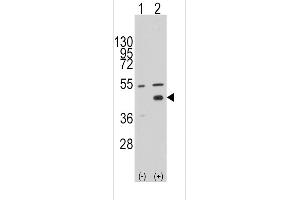 Western blot analysis of WIF1 (arrow) using rabbit polyclonal WIF1 Antibody (N-term) (ABIN389184 and ABIN2839347). (WIF1 anticorps  (N-Term))