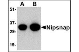 Western blot analysis of NIPSNAP in human brain tissue lysate with this product at (A) 0. (NIPSNAP1 anticorps  (C-Term))