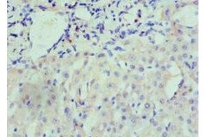 Immunohistochemistry of paraffin-embedded human liver tissue using ABIN7161434 at dilution of 1:100 (Neuropilin 1 anticorps  (AA 684-923))