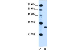 WB Suggested Anti-HFE Antibody Titration:  0. (HFE anticorps  (C-Term))