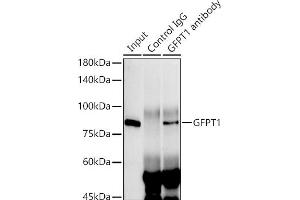Immunoprecipitation analysis of 300 μg extracts of HeLa cells using 3 μg GFPT1 antibody (ABIN7267430). (GFPT1 anticorps)