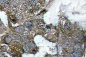 Image no. 2 for anti-Nuclear Factor of kappa Light Polypeptide Gene Enhancer in B-Cells Inhibitor, alpha (NFKBIA) antibody (ABIN265483)