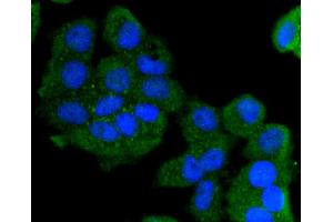MCF-7 cells were stained with Cytokeratin 13 (5A3) Monoclonal Antibody  at [1:200] incubated overnight at 4C, followed by secondary antibody incubation, DAPI staining of the nuclei and detection. (Cytokeratin 13 anticorps)