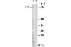 Western blot analysis of extracts from HeLa cells, treated with Calyculin A 50nM 30', using Retinoblastoma (Ab-811) Antibody. (Retinoblastoma Protein (Rb) anticorps  (AA 771-820))