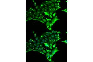 Immunofluorescence analysis of MCF-7 cell using PYGB antibody. (PYGB anticorps)
